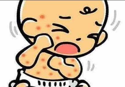 宝宝造口袋贴不牢，护理技巧不能少(图8)