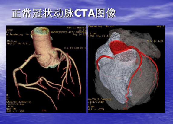 心“房”(图5)