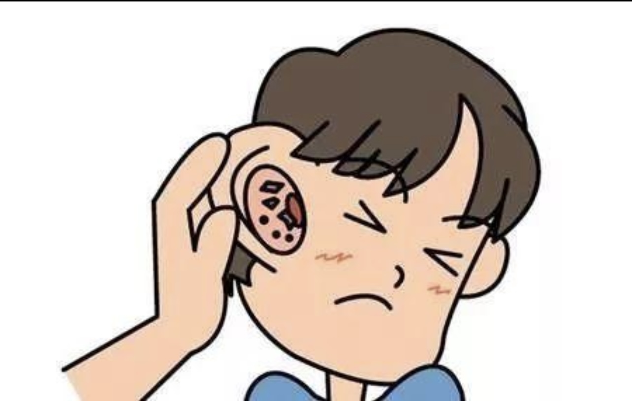  “丹毒”为什么这么毒(图3)