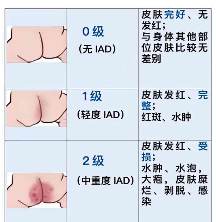 1-25021G91001321.png