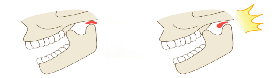 1-250Q40J634D0.png